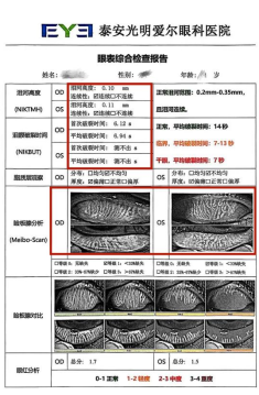 比较好的证券公司 视力1.0，却总感觉看东西模糊，竟是干眼引发的！
